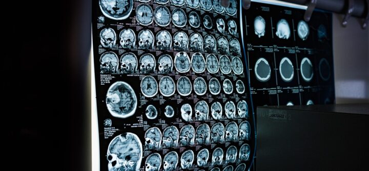 x-ray-6841384_1280