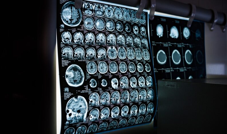 x-ray-6841384_1280