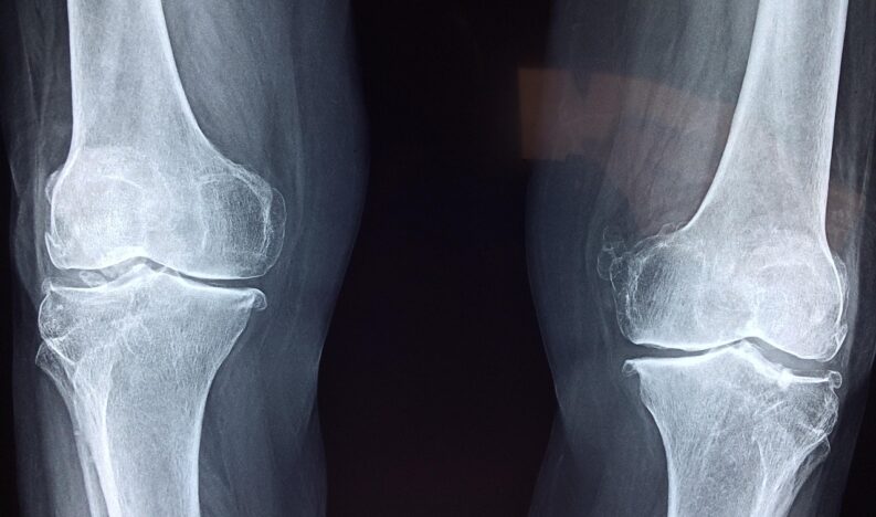 knee-2253047_1280