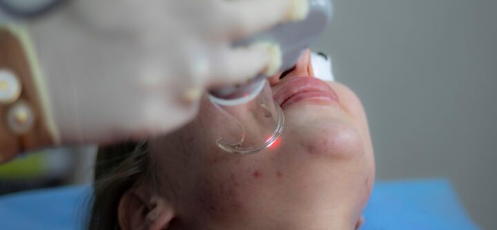 laser-treatment-6664875_1280 laser-treatment-6664875_1280